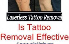 Tattoo Removal Near Me Does Laser Completely Remove Tattoo Laser